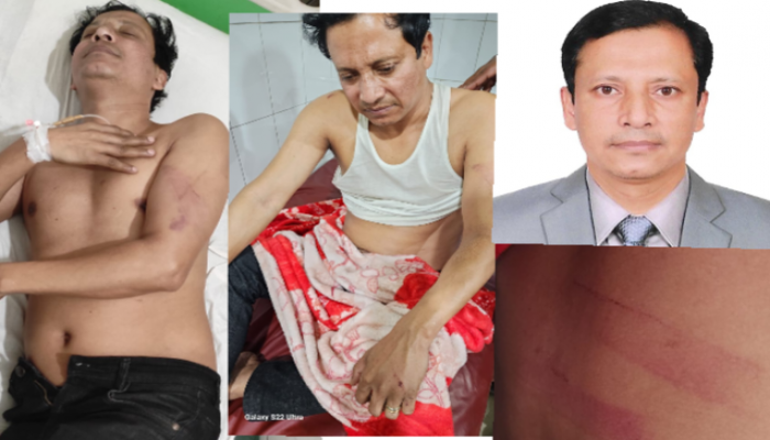 দাউদকান্দিতে জমি সংক্রান্ত পূর্ব শত্রুতার জের ধরে হুমায়ুন কবির নামক এক যুবককে পিটিয়ে আহত দাউদকান্দিতে জমি সংক্রান্ত পূর্ব শত্রুতার জের ধরে হুমায়ুন কবির নামক এক যুবককে পিটিয়ে আহত